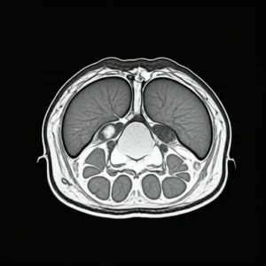 Hepatobiliary MRI 2026